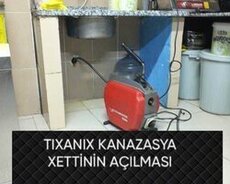 Kanalizasiya acma xidməti 7/24 saat